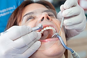 Closeup of a dental instruments being used by the dentist during a dental treatment for a beautiful woman