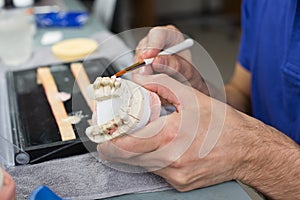 Closeup of a dental technician applying porcelain to a mold