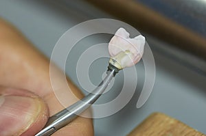 Closeup of dental technician putting ceramic to dental implants