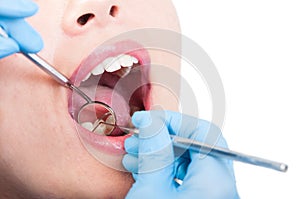Closeup of dentist examining woman teeth in dental office