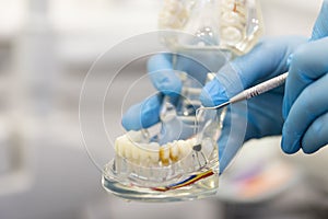 Closeup of dentist holding teeth model denture, showing what pulpitis looks like