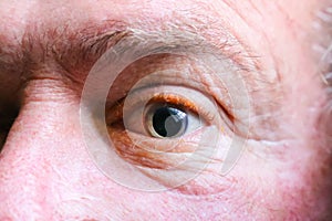 Closeup of a dilated eyeball