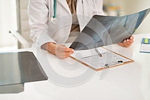 Closeup on doctor woman holding fluorography photo
