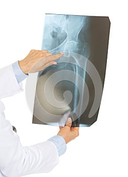 Closeup on doctor woman pointing on fluorography