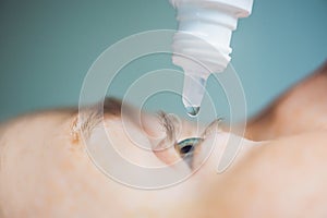 Closeup of eyedropper putting liquid into open eye