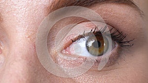 Closeup of female blinking, suffering dry eye syndrome, vision problems fatigue