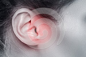 Closeup of female ear with source of pain