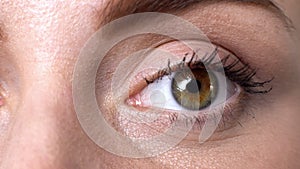 Closeup of female eye, suffering dry eye syndrome, vision problems fatigue