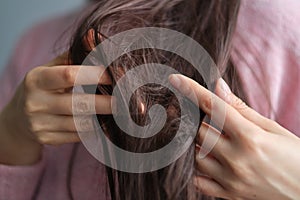 closeup female holding messy unbrushed dry hair in Hands. Hair damage concept.