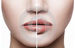 Closeup of female lips before and after augmentation procedure