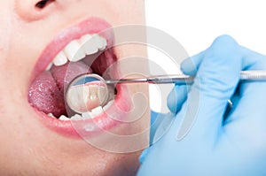 Closeup of gloved dentist checking teeth health of female patient