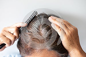 Closeup Hair grows on the head of an old woman