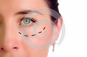 Closeup half of face caucasian woman with dotted lines drawn around left eye, preparing cosmetic surgery