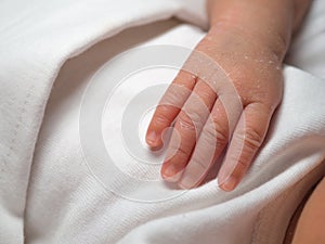 Closeup hand of a newborn with a skin peeling on white cloth. Skin allergies in newborn called Vernix. the concept of health care