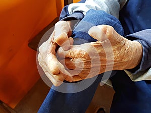 Closeup hands of asian old man suffering from leprosy, Thailand. photo