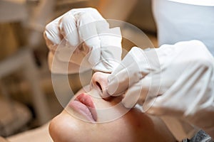 Closeup of hands in gloves squeezing and removing pimples using wipes from young woman& x27;s nose and face in beauty spa