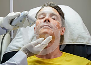 Closeup handsome man having color light therapy to stimulate facial skin