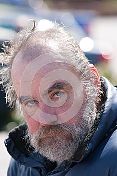 Closeup of homeless man