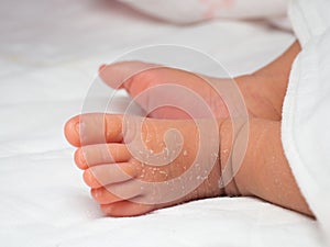 Closeup instep or foot of a newborn with a skin peeling on white cloth. Skin allergies in newborn called Vernix. the concept of he photo