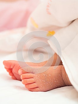 Closeup instep or foot of a newborn with a skin peeling on white cloth. Skin allergies in newborn called Vernix. the concept of he