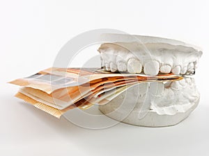 Closeup kid orthodontic dental impression chalk model biting euro money on white background