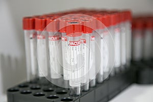 Closeup of lab equipment for scientific research with fluids