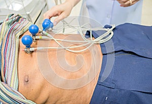 Closeup Making ECG for patient at the hospital . Heart analysis, electrocardiogram graph