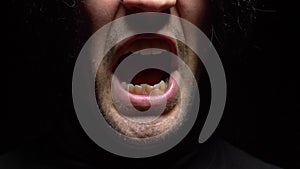 Closeup. male mouth with crooked teeth screaming. Black background.