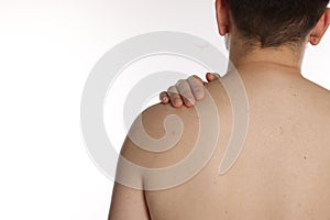 Closeup of man`s body with birthmarks on white background, back view. Space for text