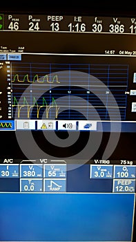 Closeup of a mechanical ventilator,s control panel