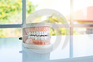 Closeup for mock up of dental circular bridge