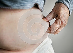 Closeup of obese elderly woman