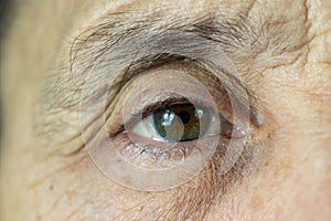 Closeup old man eye