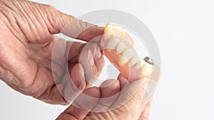 Closeup of older womans hand holding dentures