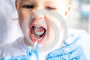 Closeup open mouth child and mirror in dentists hands in blue gloves checkup examine treating teeth to child, health