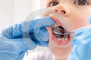 Closeup open mouth child and mirror in dentists hands in blue gloves checkup examine treating teeth to child, health