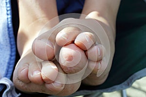 Closeup of a pair of bare feet and shrivelled up toes