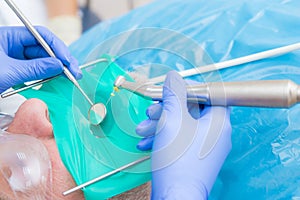 Closeup picture of dental instruments: drill and needle for root canal treatment and pulpitis in hand at the dentist