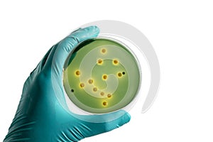 Closeup for plate bacteria culture growth on selective media