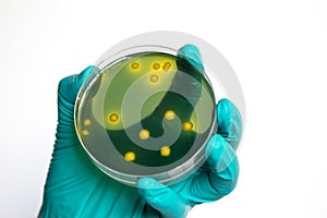 Closeup for plate Bacteria culture growth on Selective media
