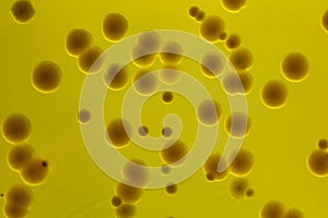Closeup for plate Bacteria culture growth on Selective media,