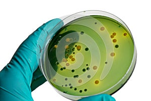 Closeup for plate Bacteria culture growth on Selective media, vi