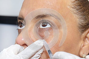 Closeup Of Platelet Rich Plasma PRP Cosmetic Therapy Near A Woman`s Eyes, Being Injected With Needle Poking