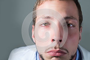 Closeup portrait of sad young doctor crying