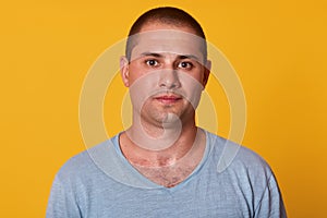 Closeup portrait of thoughtful serious handsome man standing isolated over yellow background in studio, looking directly at camera