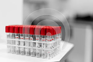 Dnepr/Ukraine - 02.07.2019: Closeup set of sterile vacuum test-tubes for blood sample. Science and medicine concept