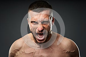 Bruised fighter on gray background