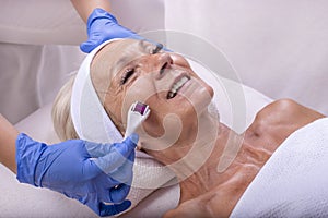 Closeup shot of a beautiful female in beauty salon during mesotherapy procedure with derma roller