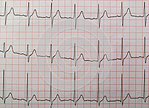 Closeup shot of electrocardiogram