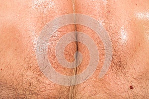 Closeup of skin on male back